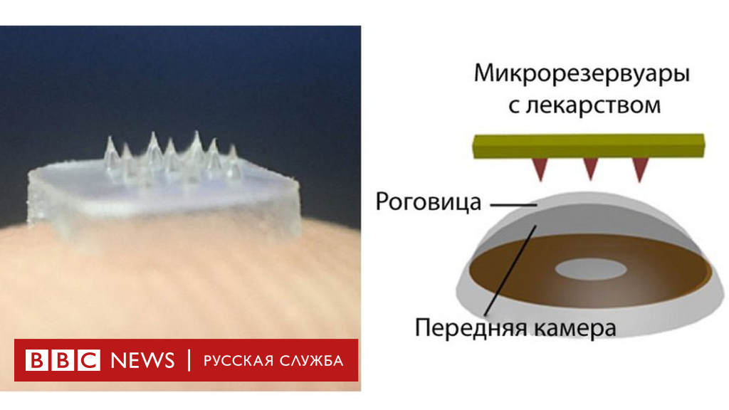 104308777 eye patch with spikes on it 1 Новости BBC Новости BBC