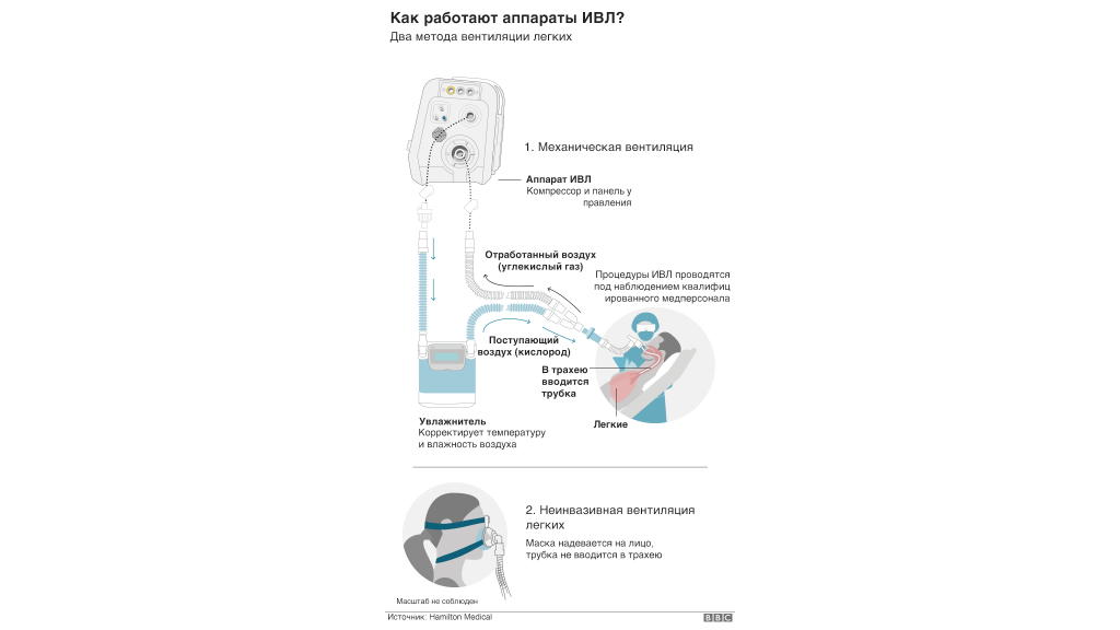 111453741 xw8g5dxd 1 Новости BBC аппараты ИВЛ, коронавирус