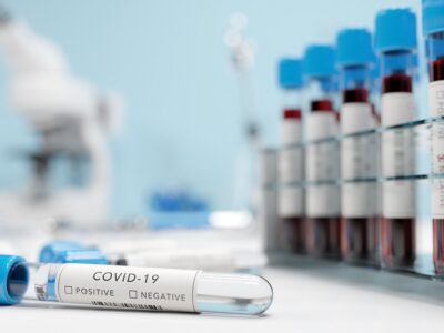 testing for coronavirus covid 19 in a lab covid m 2021 08 28 20 03 53 utc новости Covid-19, коронавирус в Грузии