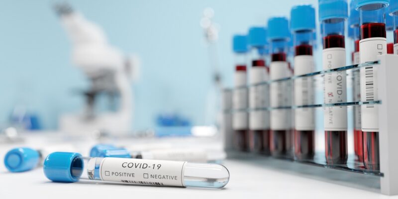 testing for coronavirus covid 19 in a lab covid m 2021 08 28 20 03 53 utc новости Covid-19, пандемия коронавируса