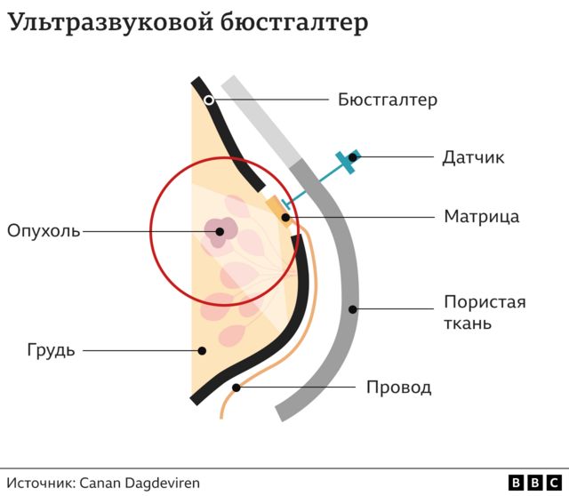 Устройство аппарата