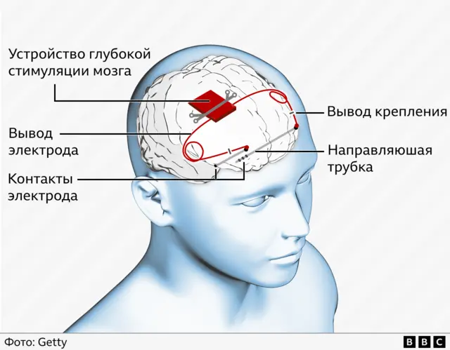 Графика: устройство нейромедиатора