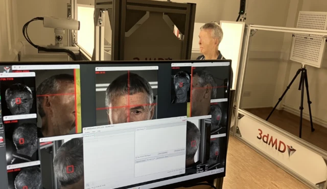 В Великобритании для пострадавшего в аварии велосипедиста напечатали на 3D-принтере часть лица 3 Оборудование для сканирования