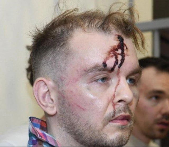 Лицо мужчины со следами побоев и запекшейся кровью на лбу