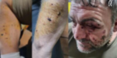 32131 статьи война в Украине, грузинский боец, ранение
