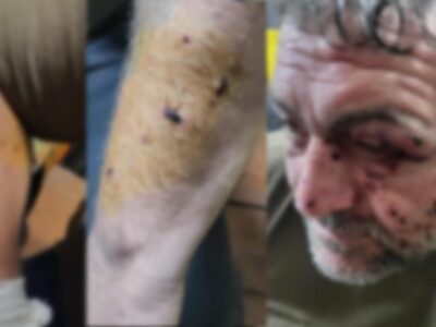 32131 новости война в Украине, грузинский боец, ранение