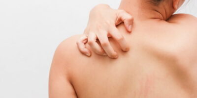 97cbfc40ac5a80b87b244bffe286a996 новости зараза, кожное заболевание, Минздрав Грузии, Минобразования Грузии, чесотка