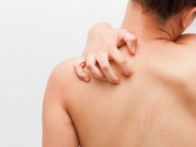 Минобразования Грузии не подтверждает "массового" распространения чесотки в школах и детсадах 2 97cbfc40ac5a80b87b244bffe286a996 новости зараза, кожное заболевание, Минздрав Грузии, Минобразования Грузии, чесотка