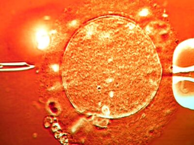 Сперма донора с мутировавшим геном, вызывающим рак, была использована для зачатия почти 200 детей по всей Европе 5 ff8d66c0 d4ed 11f0 8c06 f5d460985095.jpg Новости BBC донор, рак, сперма