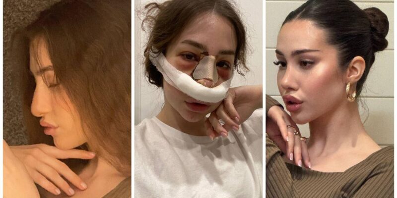 60f14820 036d 11f1 b7e1 afb6d0884c18.jpg Новости BBC пластика в России