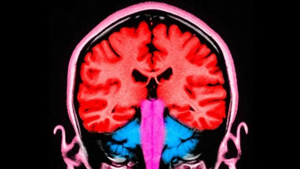 82cce4e0 096c 11f1 83d0 31a7d9d54ca7.jpg Новости BBC мозг