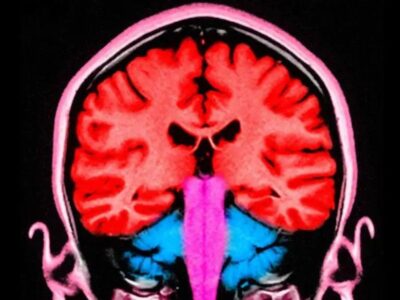 Может ли электрический импульс, направленный в мозг, сделать нас менее эгоистичными? 4 82cce4e0 096c 11f1 83d0 31a7d9d54ca7.jpg Новости BBC мозг