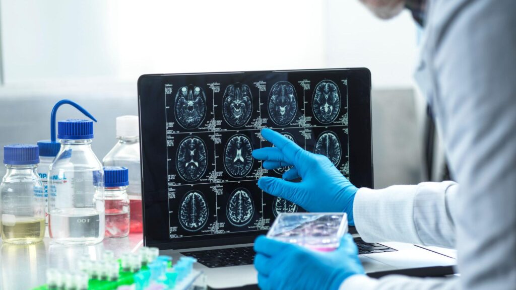 310162c0 3974 11f1 b60c af6bba5f6d25.jpg BBC News Русская служба Альцгеймер