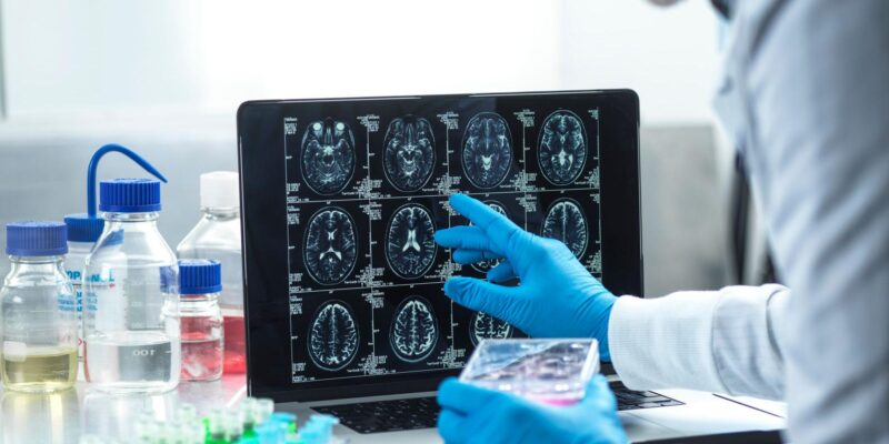 Анализ поставил под сомнение пользу новых препаратов от болезни Альцгеймера 1 310162c0 3974 11f1 b60c af6bba5f6d25.jpg BBC News Русская служба Альцгеймер